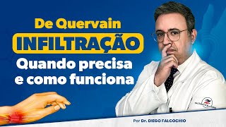 Tenossinovite de De Quervain Infiltração Quando precisa e como funciona  Série Tendinite [upl. by Aelem67]