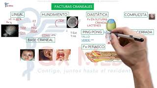 Neurocirugía  1 Traumatismo encéfalo craneano [upl. by Anitnas]