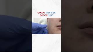 COWO MASA DI BOTOX SIH treatments trending [upl. by Maccarone]