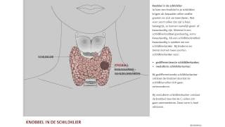 Nodus een knobbel in de schildklier [upl. by Vergil]