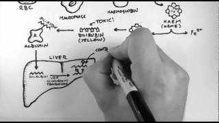 Bilirubin 1  Bilirubin Pathway [upl. by Tait252]