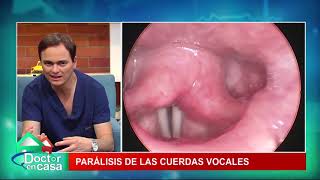 Parálisis de cuerdas vocales [upl. by Philip]