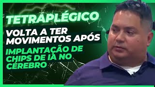 Tetraplégico volta a ter movimentos após implantação de chips de IA no cérebro [upl. by Rramaj]