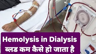 Understanding and Preventing Hemolysis Blood Loss in Dialysis  Cause of anemia in dialysis [upl. by Dolf]