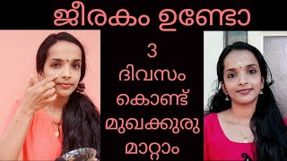 How to remove pimples naturally and permanently at home in three days♥️In Malayalam [upl. by Lai]