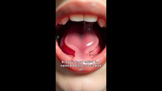 The Healing Powers of Saliva Natures Miracle [upl. by Eicarg76]