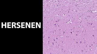 Hersenen histologiemicroscopie van de hersenen [upl. by Freberg976]