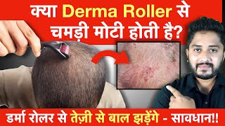 क्या डर्मा रोलर से चमड़ी मोटी होती है Derma Roller Side Effect on Hair  Genuine Tips [upl. by Blasius398]