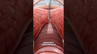 Bronchoscopy 3D Animation [upl. by Leahcimdivad189]