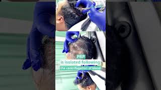 PRP  DHI Bangladesh  LaserTreat [upl. by Ardnod]