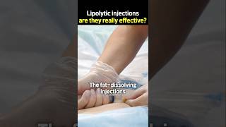 Lipolytic injections are they really effective [upl. by Primavera21]