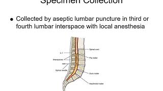 Cerebrospinal Fluid analysis [upl. by Illene636]