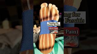 Tapping for Planter Fascitis heel pain Physiotherapy ankle pain [upl. by Nhguahs803]