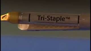 Endo GIA™ Reloads with Tri Staple™ Technology amp Endo GIA™ Ultra Universal Staplers LnsyxAlY9FM [upl. by Argile]