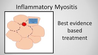 Myositis Inflammatory Myopathy Treatment [upl. by Ecinue]