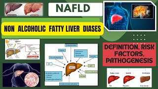 Non Alcoholic Fatty Liver Disease NAFLD in Diabetes [upl. by Lepley]