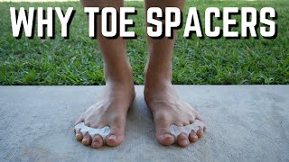 Why Toes Spacers  Guide on Different Toe Spacers [upl. by Atineg277]