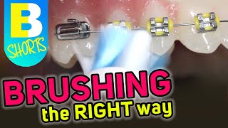 Brushing with Braces Explained  Electric Toothbrush Shorts [upl. by Elleynad182]