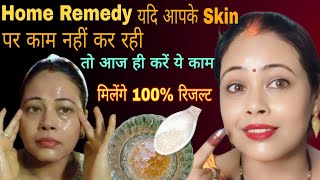 यदिHome Remedy Skin पर काम नहीं कर रही 🥹 तो आज ही करें ये उपाय मिलेंगे👍100रिजल्ट [upl. by Niboc710]