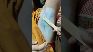 Underarm waxing with Rica waxUnderarm waxing armpit waxwaxing hackshort shorts youtubeshorts [upl. by Baiel]