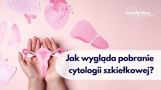 Jak wygląda pobranie cytologii szkiełkowej [upl. by Ezmeralda]