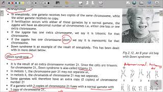 GRADE 12 LIFE SCIENCES CONSEQUENCES OF NON DISJUNCTION OF CHROMOSOMES  ABNORMAL MEIOSIS [upl. by Fania]