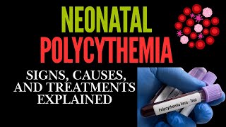 Neonatal Polycythemia Signs Causes and Treatments Explained [upl. by Nahtal807]