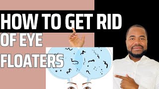 How to Get Rid of Eye Floaters [upl. by Samled]