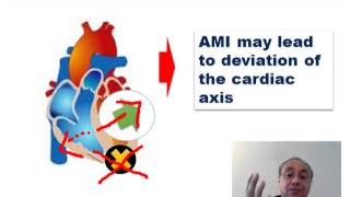 ECG CARDIAC AXIS usmle internalmedicine cme medicaleducation ecg محاضراتباطنة medical [upl. by Pineda]