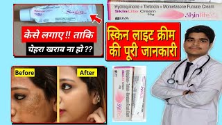 Skinlite Cream Review in Hindi  skin lite cream ko kaise use kre  UsesSide Effects and Results [upl. by Jo688]