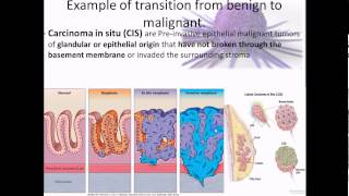 Pathophysiology 17 Cancer overview [upl. by Aiehtela]