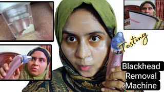 Blackheads Removal Machine Testing Vacuum Blackhead Remover Electric Face Pore Cleanersunialife [upl. by La Verne353]