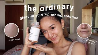 the ordinary glycolic acid toner 1 MONTH review w BEFOREAFTER [upl. by Rehm]