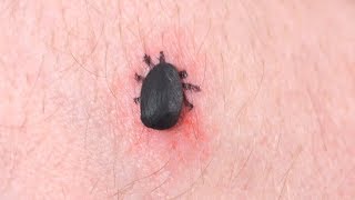 DEADLIEST TICK EVER [upl. by As]