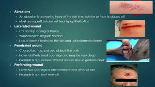 LEGAL MEDICINE LECTURE SERIES 7 MEDICOLEGAL ASPECTS OF PHYSICAL INJURIES [upl. by Ddat39]