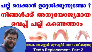 കൃത്രിമദന്തങ്ങൾ  വെപ്പ് പല്ല്  Artficial Teeth Replacement  Dental Implant veppu pallu  Part 2 [upl. by Syramad]