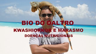 KWASHIORKOR E MARASMO  CASOS DE DESNUTRIÇÃO [upl. by Debby286]