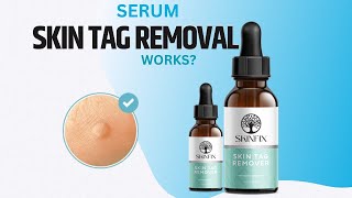 Skinfix Skin Tag Removal Review  Serum Skin Tags  Benefits Ingredients How to use [upl. by Xam55]