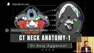 CT Neck Anatomy Radiology Basics Anuj Aggarwal [upl. by Shela947]