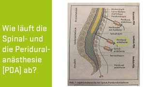 PDA Schmerzarme Geburt in der Privatklinik Döbling [upl. by Tlok]