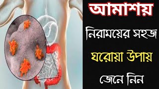 কাশির সাথে রক্ত আসা ফুসফুসের ক্যান্সার নয় তো Haemoptysiscauses investigation amp treatment [upl. by Lewanna]