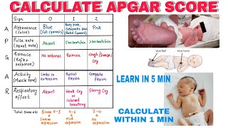 How To Calculate APGAR Score  Pediatrics [upl. by Carpio]