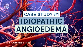 Idiopathic Angioedema  Case Study 1 The Inflammation Files with Dr Kara Wada [upl. by Daeriam]