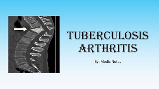 Ortho Tuberculosis arthritis  TB in joints spine TB gibbus deformity investigation treatment [upl. by Lorac994]