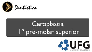 Ceroplastia 1º Pré molar superior [upl. by Ailaht420]