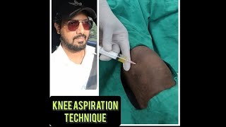 Knee AspirationHemarthrosis DrainSynovial fluid aspirationseptic arthritis joint lavage [upl. by Saretta900]