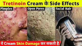 Tretinoin Cream के ये Side Effects आप नहीं जानते होगे 😱 [upl. by Kruse]