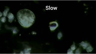 Trichomonas in urine Dark field microscopy [upl. by Dnomaj83]