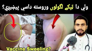 Sweeling leg 🦵 or Aram After Injection of Vaccine Cause and Frist aid ⛑️in Pashto by Dr Mustaqeem [upl. by Francklin]