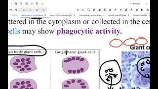 pathology  chronic inflammation [upl. by Orodoet]